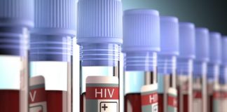 Teste de HIV feito pel CEDLABS laboratório ajuda a salvar vidas.