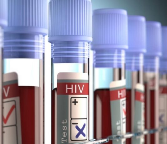 Teste de HIV feito pel CEDLABS laboratório ajuda a salvar vidas.