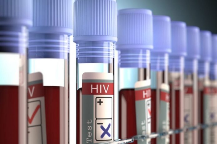 Teste de HIV feito pel CEDLABS laboratório ajuda a salvar vidas.